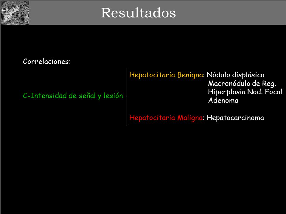 Resultados Correlaciones: Hepatocitaria Benigna: Nódulo displásico