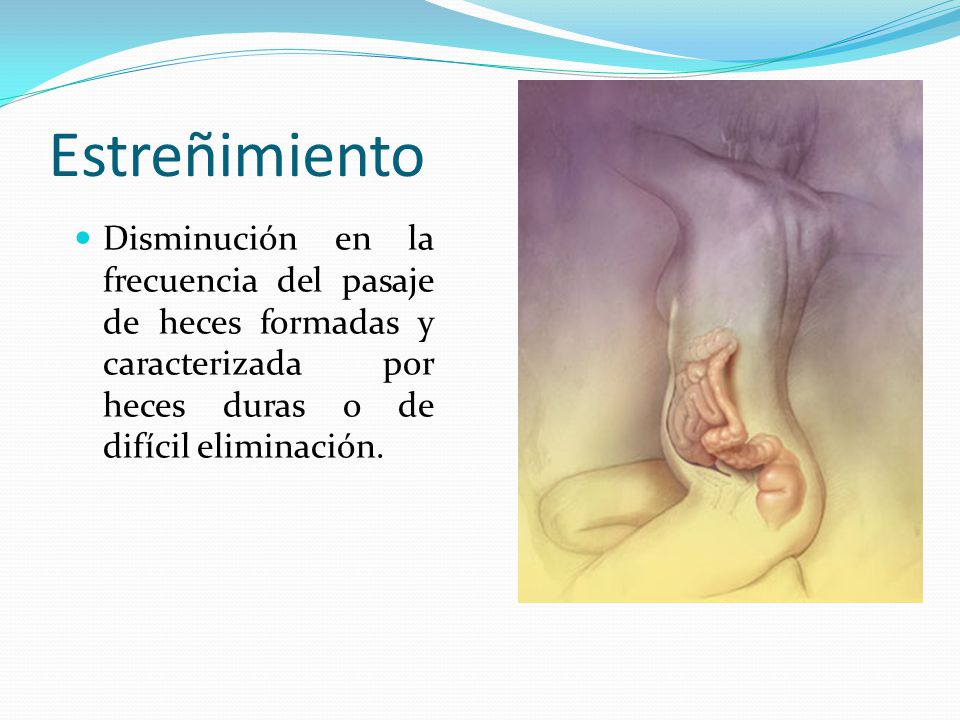 Estreñimiento Disminución en la frecuencia del pasaje de heces formadas y caracterizada por heces duras o de difícil eliminación.