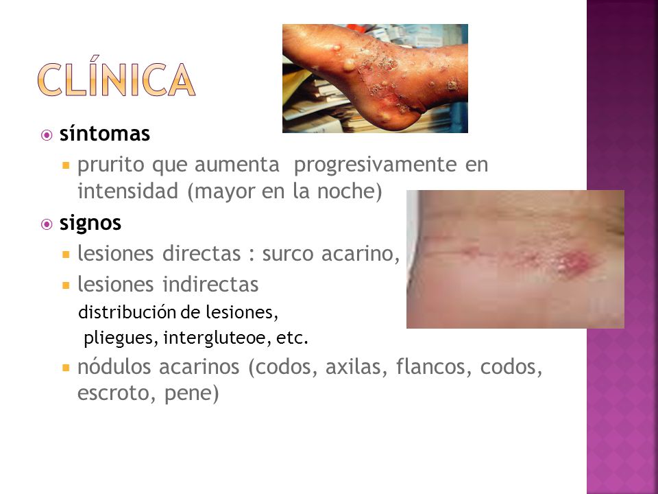 Clínica síntomas. prurito que aumenta progresivamente en intensidad (mayor en la noche) signos.