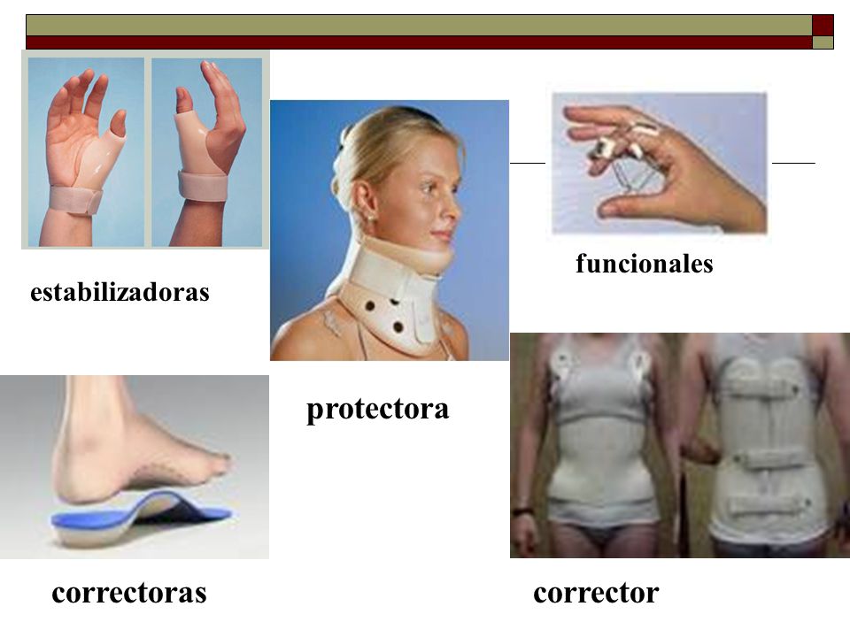 funcionales estabilizadoras protectora correctoras corrector