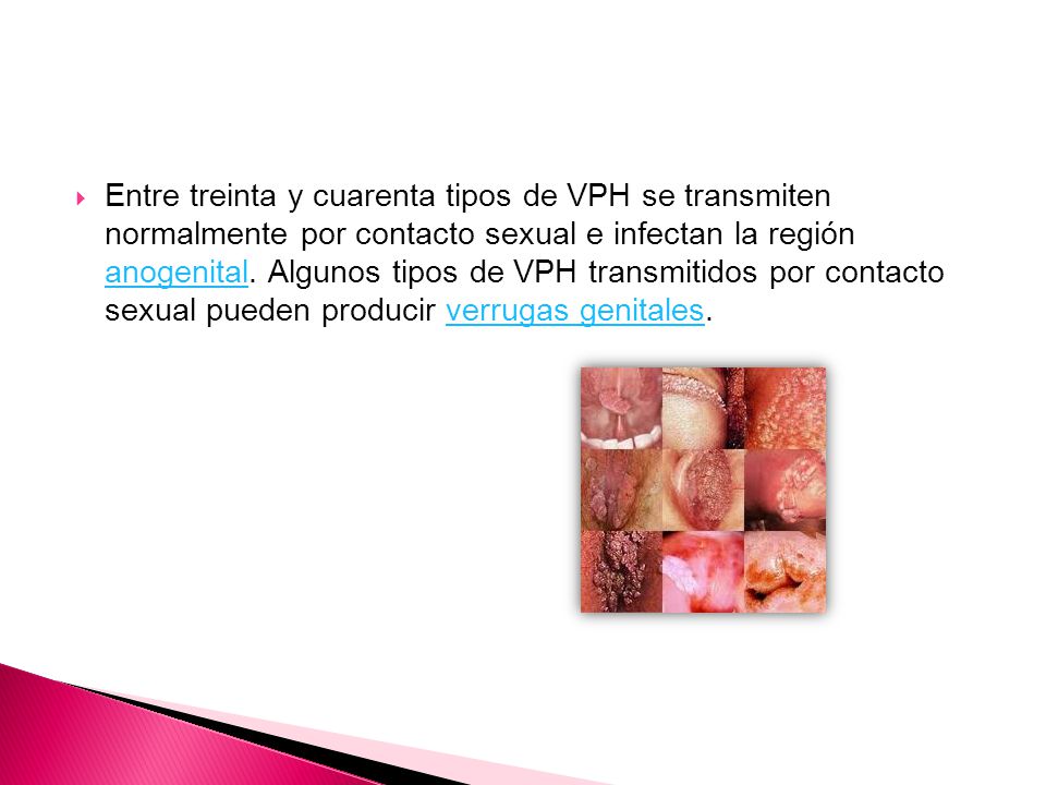Entre treinta y cuarenta tipos de VPH se transmiten normalmente por contacto sexual e infectan la región anogenital.