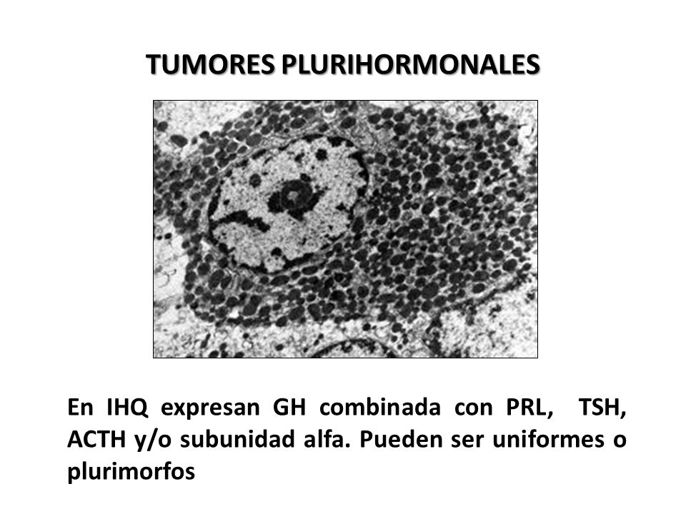 TUMORES PLURIHORMONALES