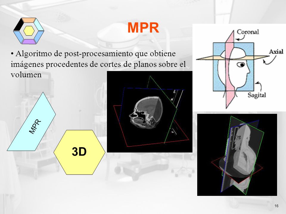 MPR Algoritmo de post-procesamiento que obtiene imágenes procedentes de cortes de planos sobre el volumen.
