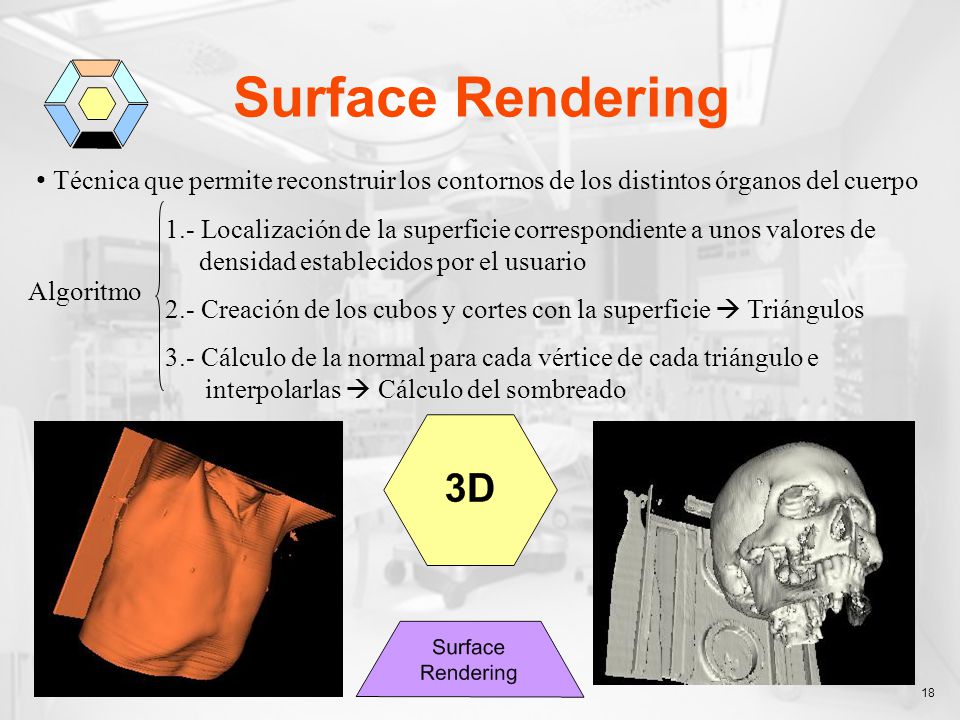 Surface Rendering Técnica que permite reconstruir los contornos de los distintos órganos del cuerpo.