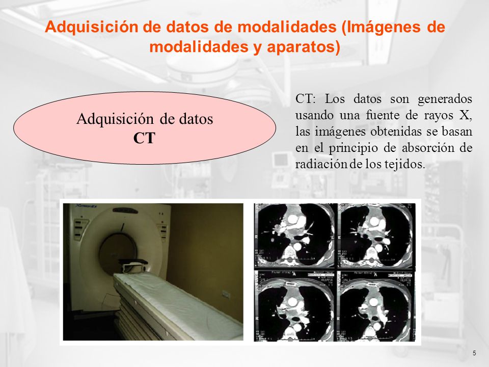 Adquisición de datos de modalidades (Imágenes de modalidades y aparatos)