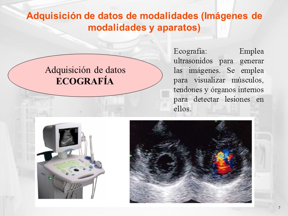Adquisición de datos de modalidades (Imágenes de modalidades y aparatos)