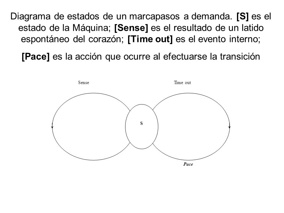 Diagrama de estados de un marcapasos a demanda