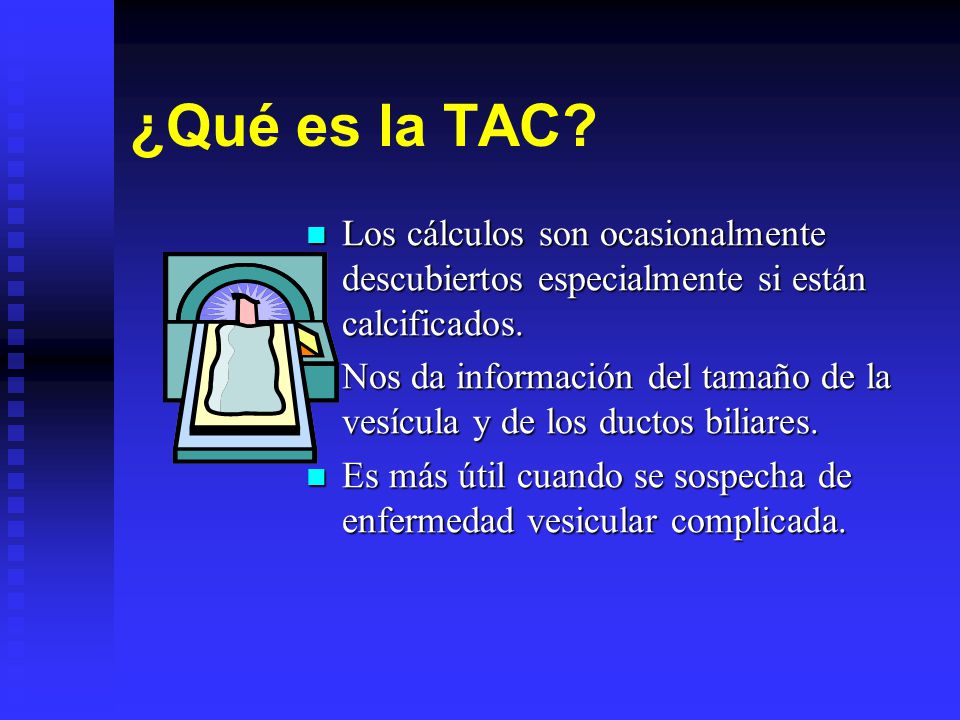¿Qué es la TAC Los cálculos son ocasionalmente descubiertos especialmente si están calcificados.