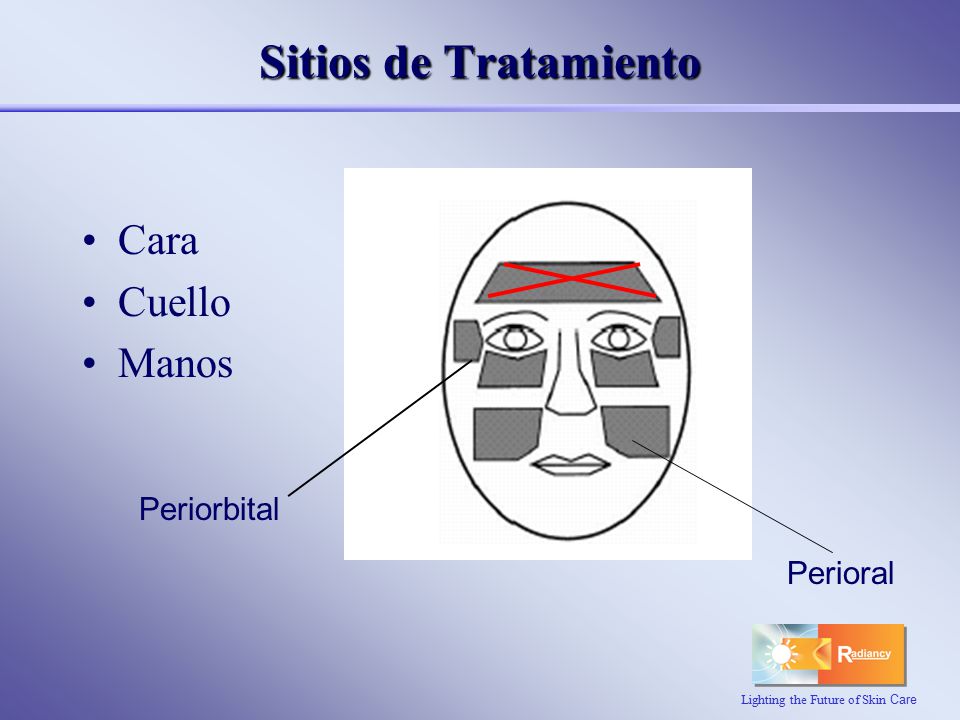 Sitios de Tratamiento Cara Cuello Manos Periorbital Perioral