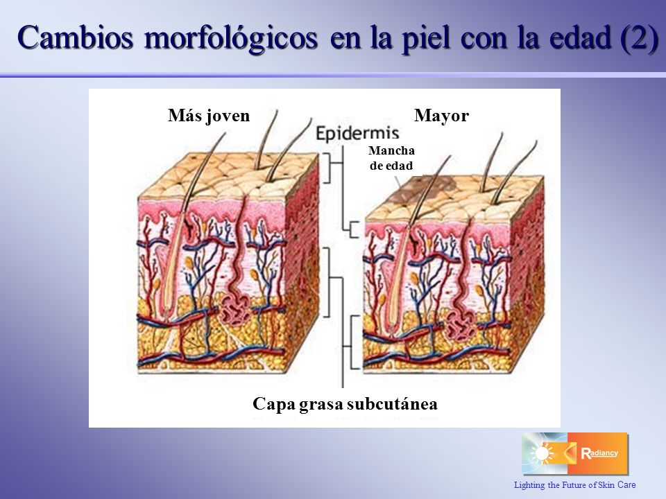 Cambios morfológicos en la piel con la edad (2)
