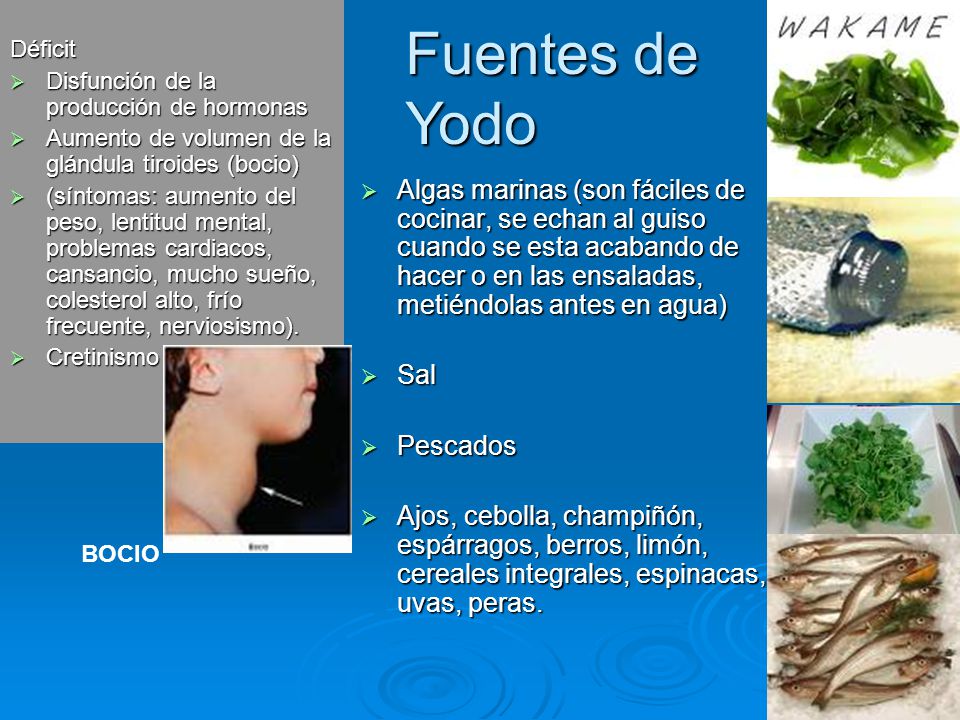 Déficit Disfunción de la producción de hormonas. Aumento de volumen de la glándula tiroides (bocio)