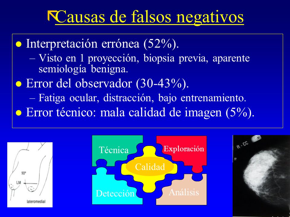 Causas de falsos negativos