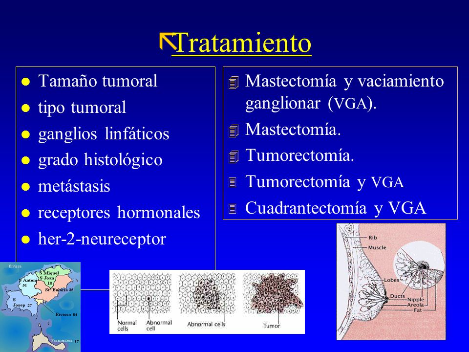 Tratamiento Tamaño tumoral tipo tumoral ganglios linfáticos