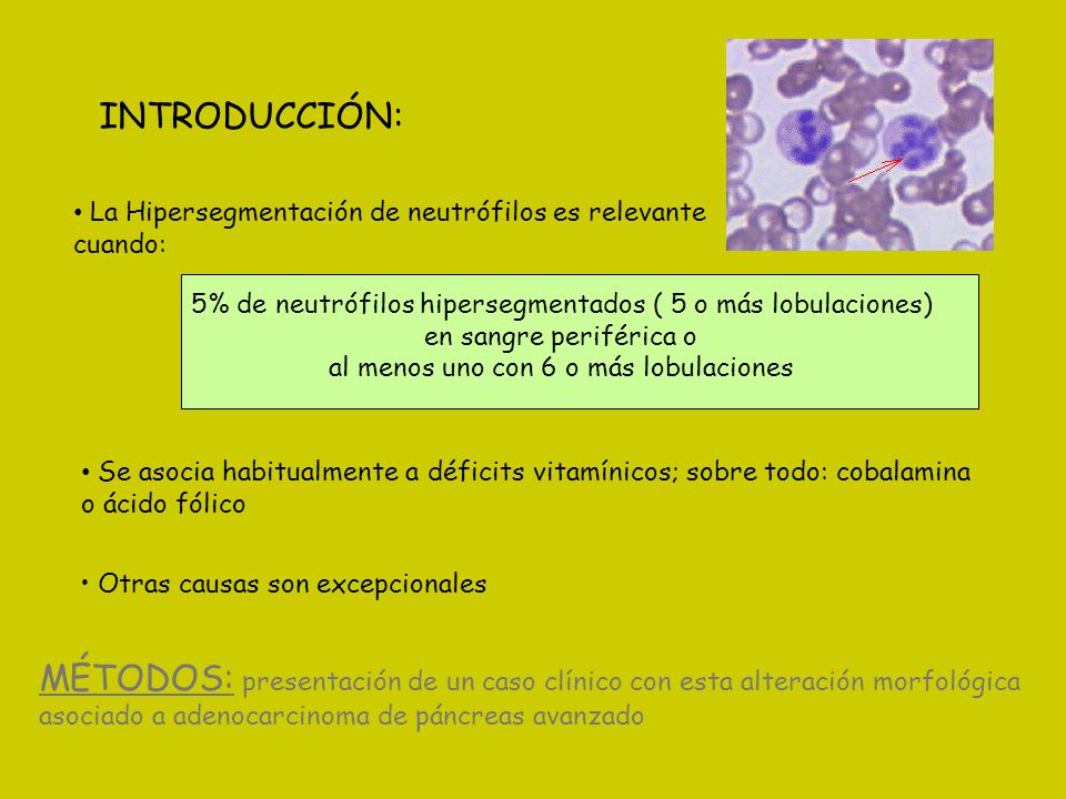 INTRODUCCIÓN: La Hipersegmentación de neutrófilos es relevante. cuando: 5% de neutrófilos hipersegmentados ( 5 o más lobulaciones)
