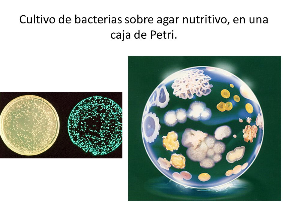 Cultivo de bacterias sobre agar nutritivo, en una caja de Petri.