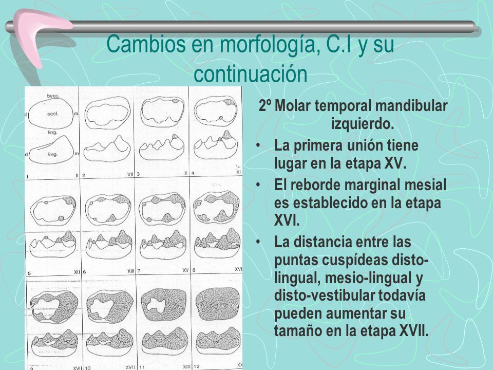 Cambios en morfología, C.I y su continuación
