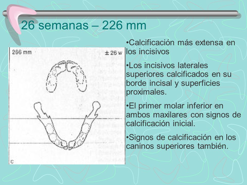 26 semanas – 226 mm Calcificación más extensa en los incisivos