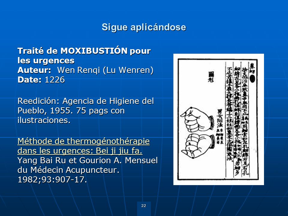 Sigue aplicándose Traité de MOXIBUSTIÓN pour les urgences Auteur: Wen Renqi (Lu Wenren) Date:
