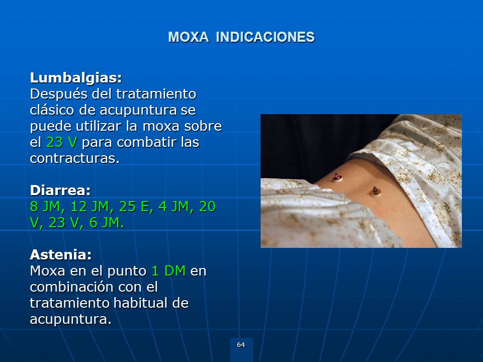 MOXA INDICACIONES Lumbalgias: Después del tratamiento clásico de acupuntura se puede utilizar la moxa sobre el 23 V para combatir las contracturas.