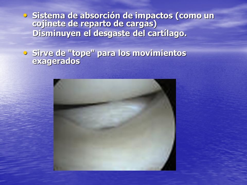 Sistema de absorción de impactos (como un cojinete de reparto de cargas)