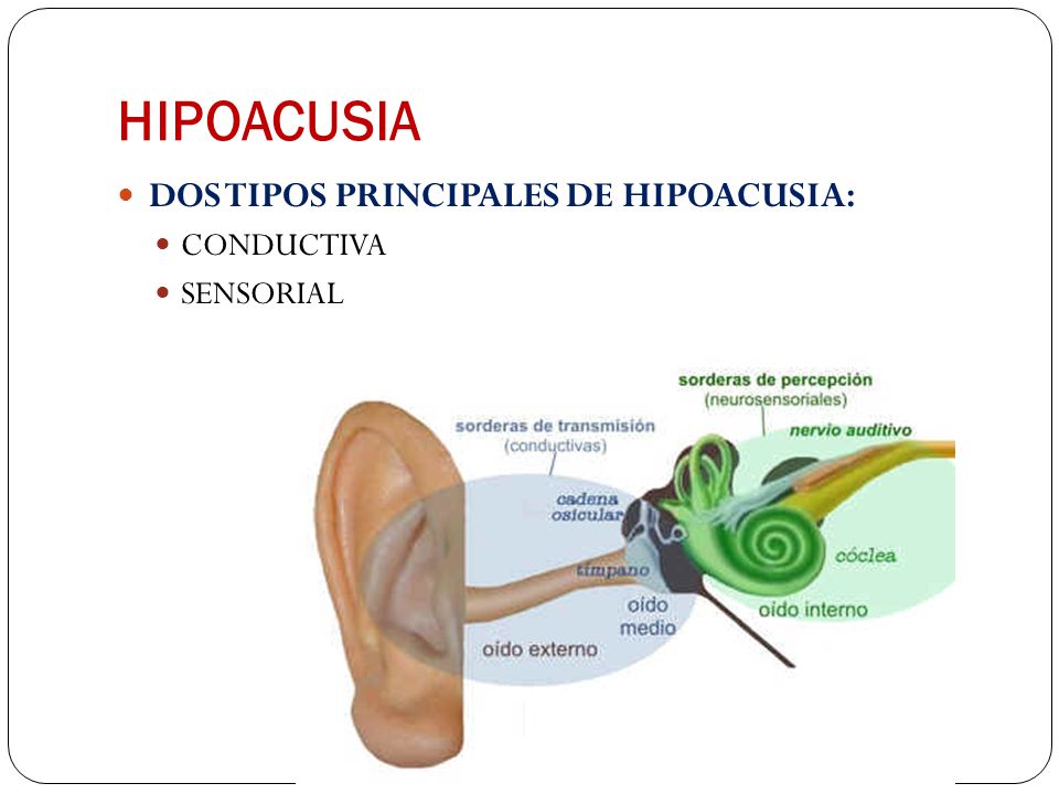 HIPOACUSIA DOS TIPOS PRINCIPALES DE HIPOACUSIA: CONDUCTIVA SENSORIAL