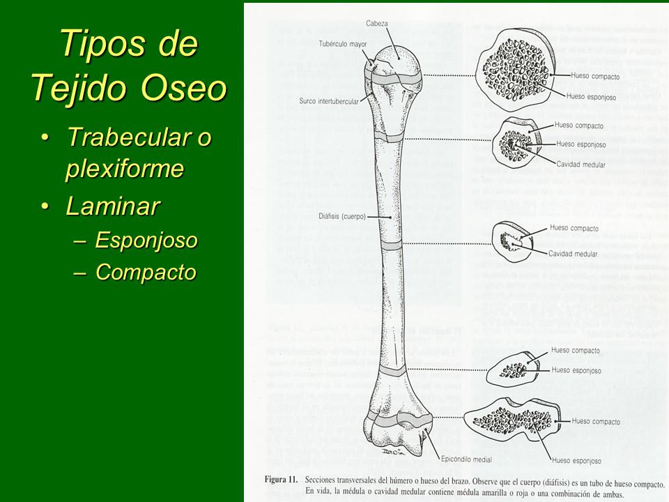 Tipos de Tejido Oseo Trabecular o plexiforme Laminar Esponjoso