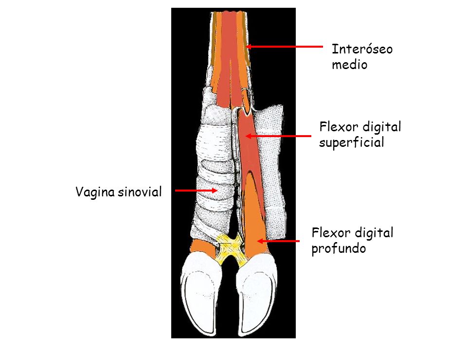 Interóseo medio Flexor digital superficial Vagina sinovial Flexor digital profundo