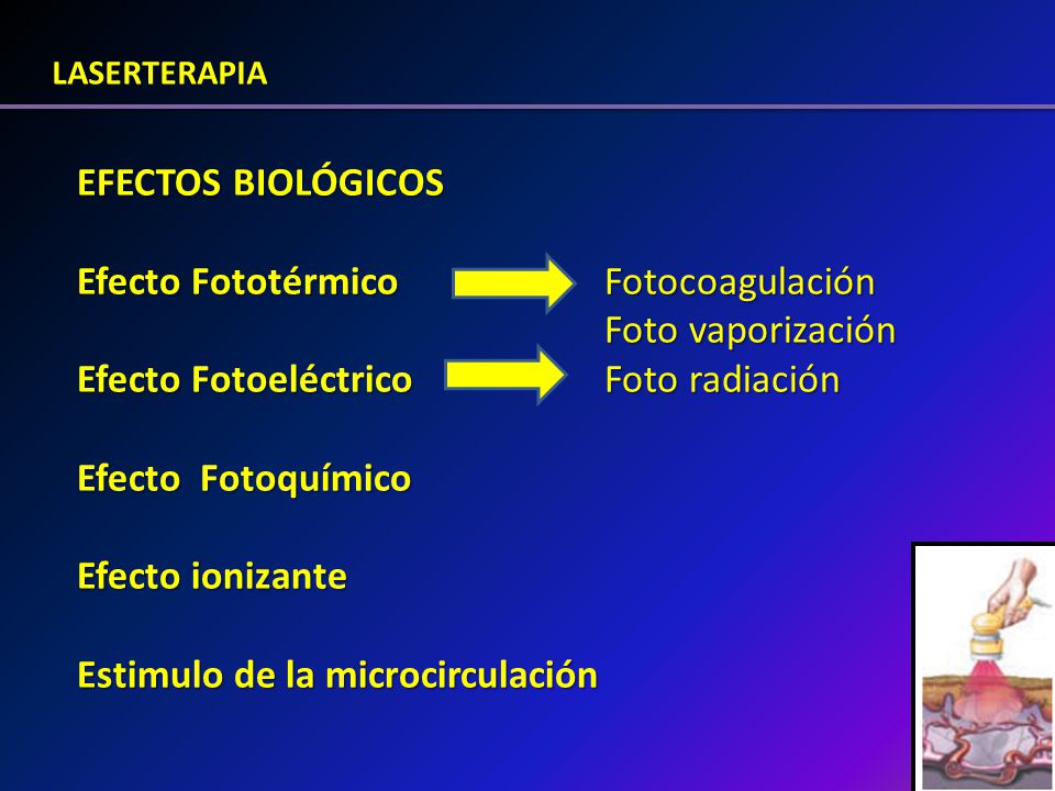 Efecto Fototérmico Fotocoagulación Foto vaporización
