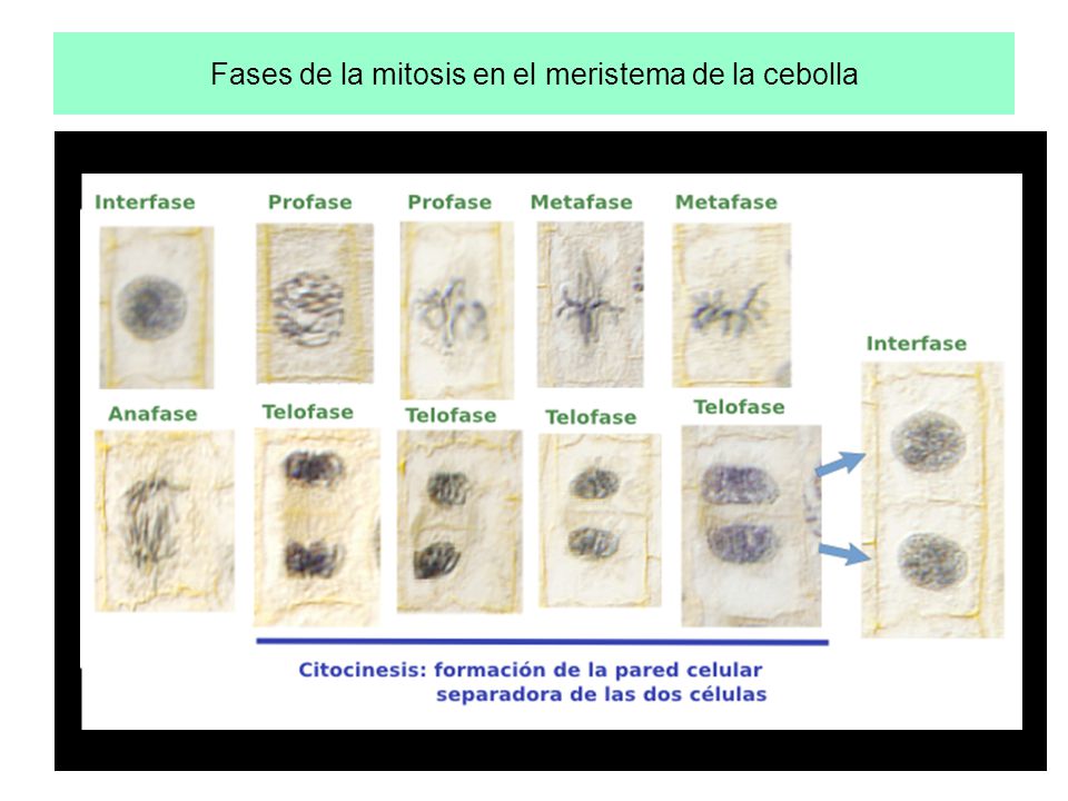 Fases de la mitosis en el meristema de la cebolla