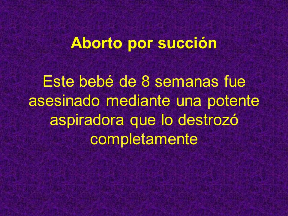 Aborto por succión Este bebé de 8 semanas fue asesinado mediante una potente aspiradora que lo destrozó completamente