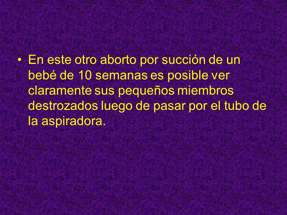 En este otro aborto por succión de un bebé de 10 semanas es posible ver claramente sus pequeños miembros destrozados luego de pasar por el tubo de la aspiradora.