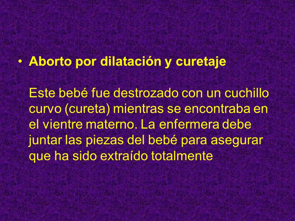 Aborto por dilatación y curetaje Este bebé fue destrozado con un cuchillo curvo (cureta) mientras se encontraba en el vientre materno.