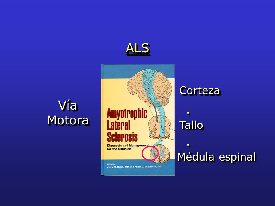 ALS Corteza Vía Motora Tallo Médula espinal