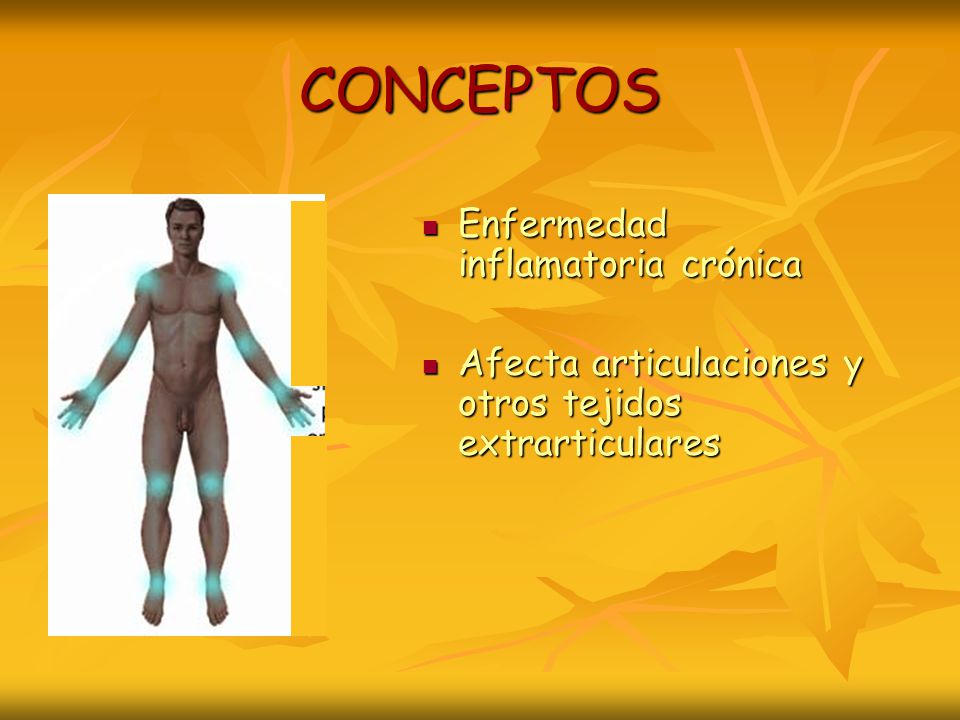 CONCEPTOS Enfermedad inflamatoria crónica