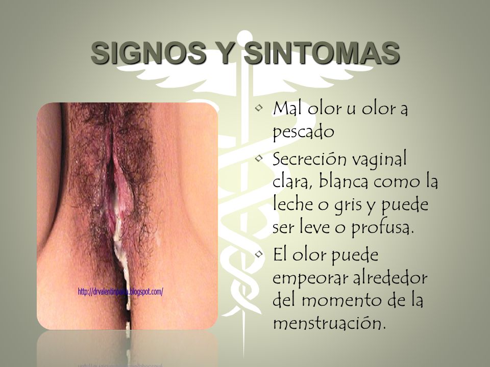 SIGNOS Y SINTOMAS Mal olor u olor a pescado