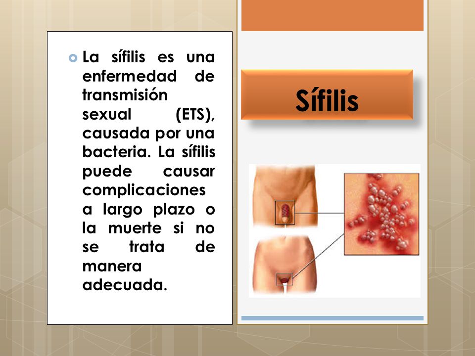 La sífilis es una enfermedad de transmisión sexual (ETS), causada por una bacteria. La sífilis puede causar complicaciones a largo plazo o la muerte si no se trata de manera adecuada.