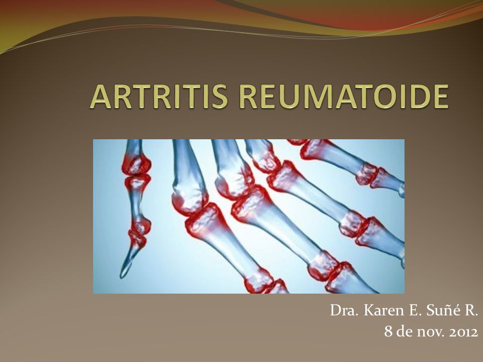 ARTRITIS REUMATOIDE Dra. Karen E. Suñé R. 8 de nov. 2012