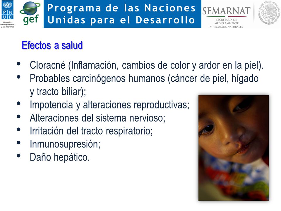 Efectos a salud Cloracné (Inflamación, cambios de color y ardor en la piel).