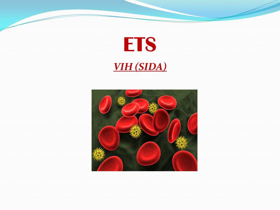 ETS VIH (SIDA)