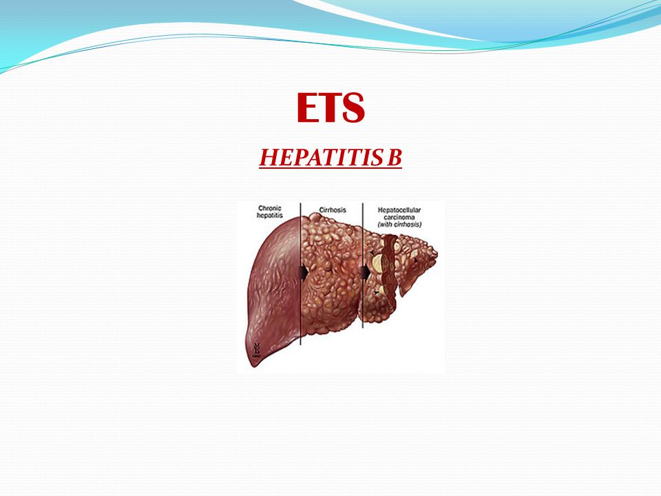 ETS HEPATITIS B