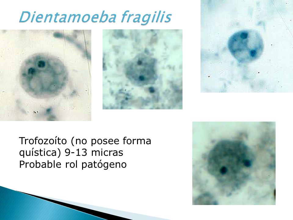 Dientamoeba fragilis Trofozoíto (no posee forma quística) 9-13 micras