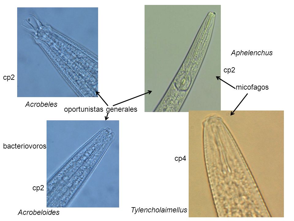 Aphelenchus cp2. cp2. micofagos. Acrobeles. oportunistas generales. bacteriovoros. cp4. cp2.