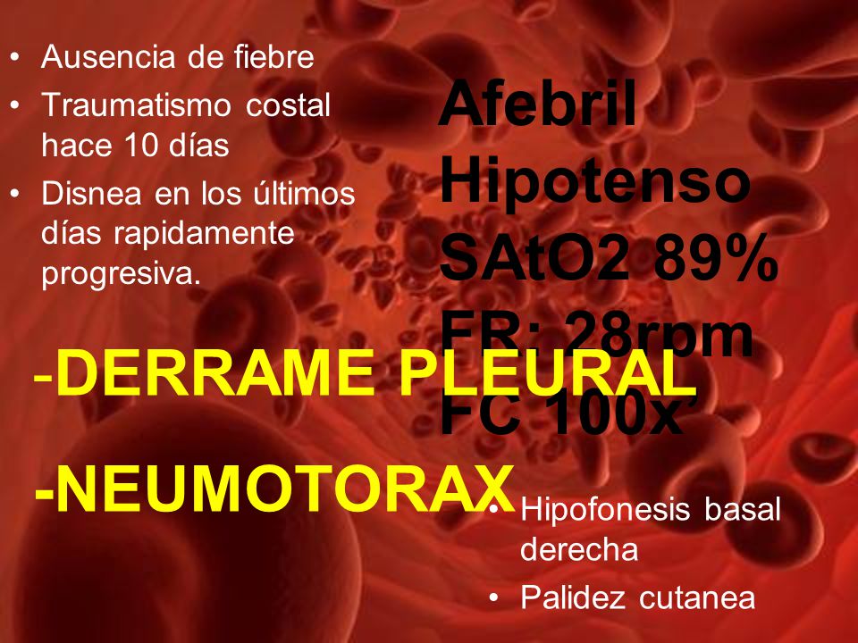 Afebril Hipotenso SAtO2 89% FR: 28rpm FC 100x’ -DERRAME PLEURAL
