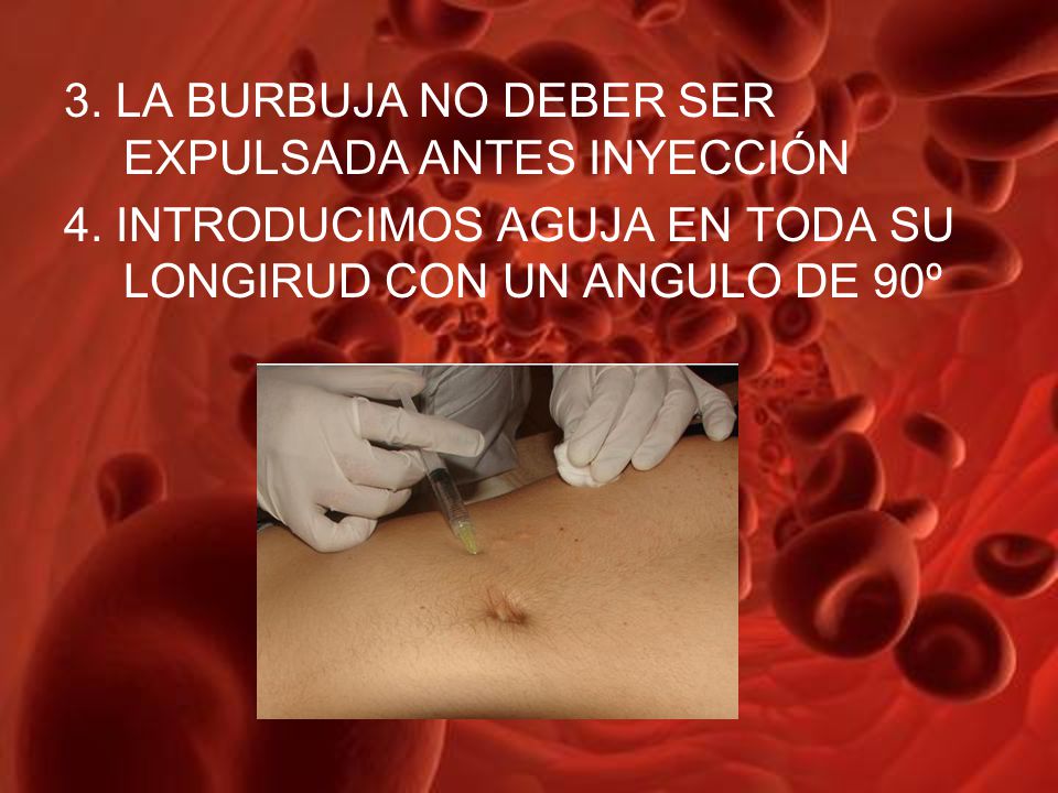 3. LA BURBUJA NO DEBER SER EXPULSADA ANTES INYECCIÓN 4