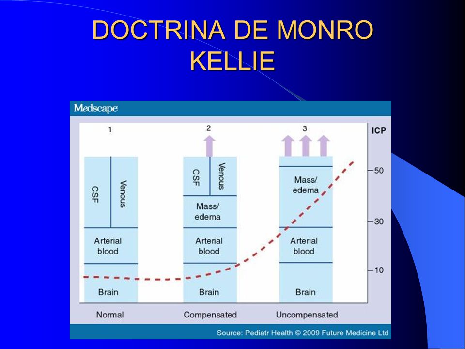 la doctrina de monro kellie