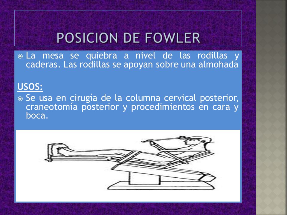 POSICION DE FOWLER La mesa se quiebra a nivel de las rodillas y caderas. Las rodillas se apoyan sobre una almohada.