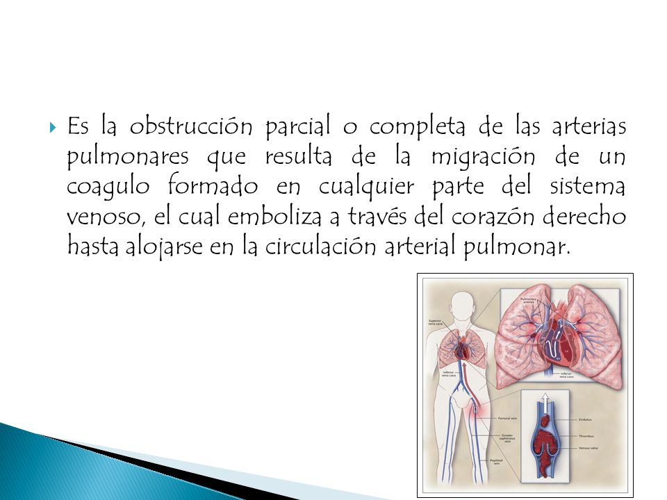 Es la obstrucción parcial o completa de las arterias pulmonares que resulta de la migración de un coagulo formado en cualquier parte del sistema venoso, el cual emboliza a través del corazón derecho hasta alojarse en la circulación arterial pulmonar.