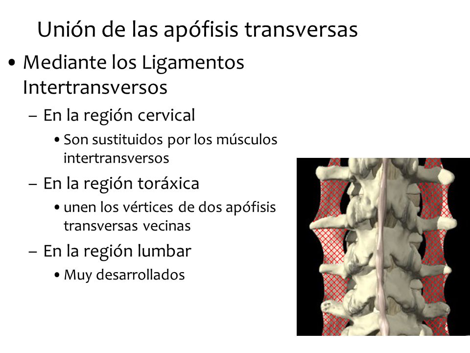 Unión de las apófisis transversas