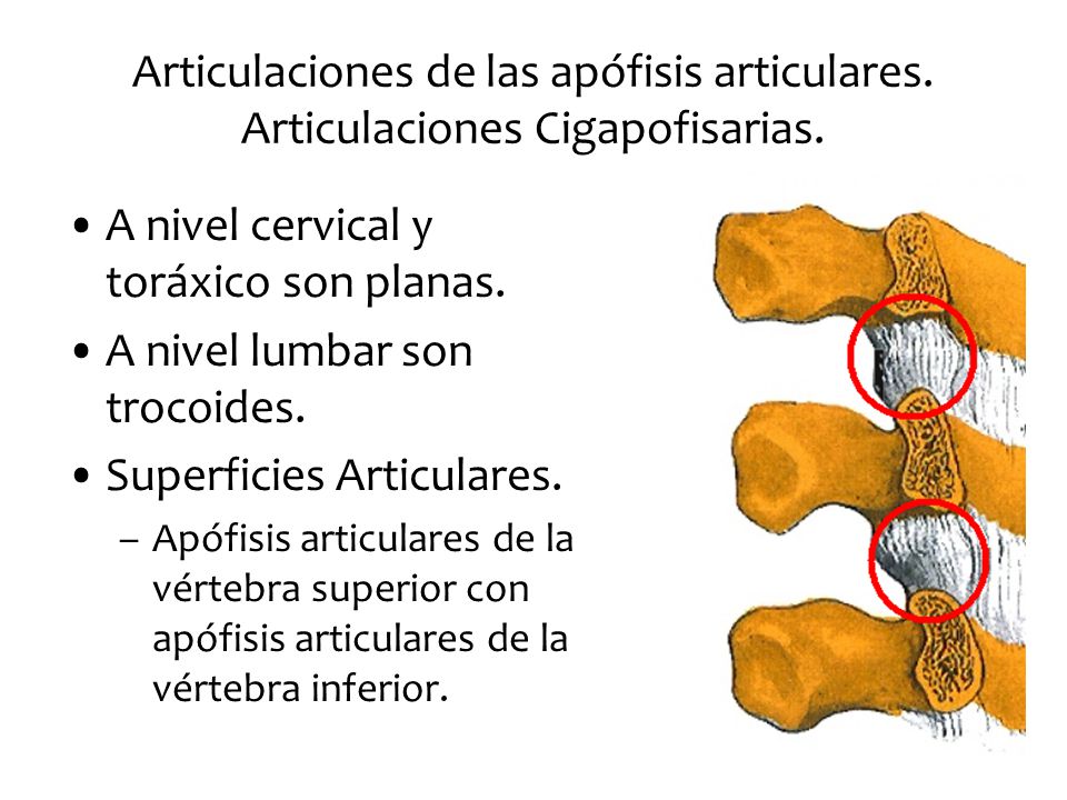 A nivel cervical y toráxico son planas. A nivel lumbar son trocoides.