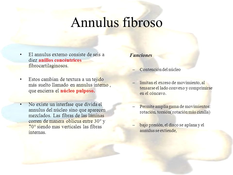 Annulus fibroso El annulus externo consiste de seis a diez anillos concéntricos fibrocartilaginosos.